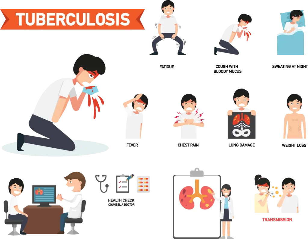 tuberculosis